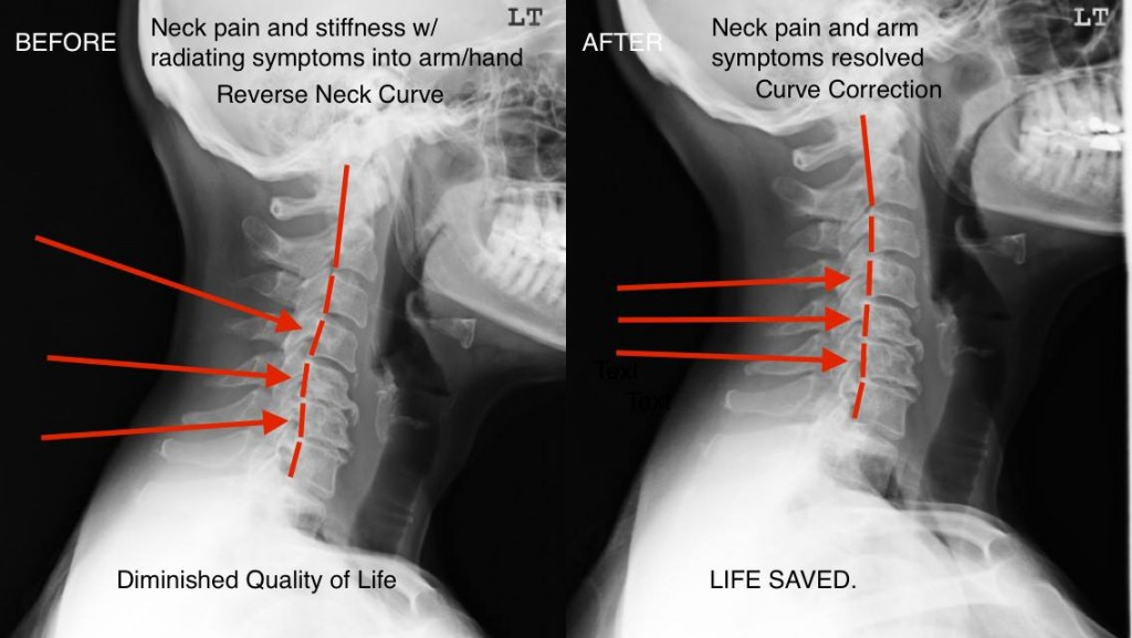 https://www.abundanthealthchiro.com/results/